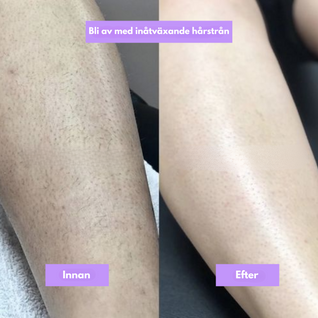 NordicSkin - Cyperus Rotundus