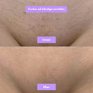 NordicSkin - Cyperus Rotundus