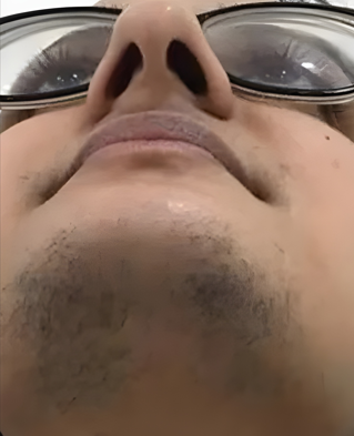 Före